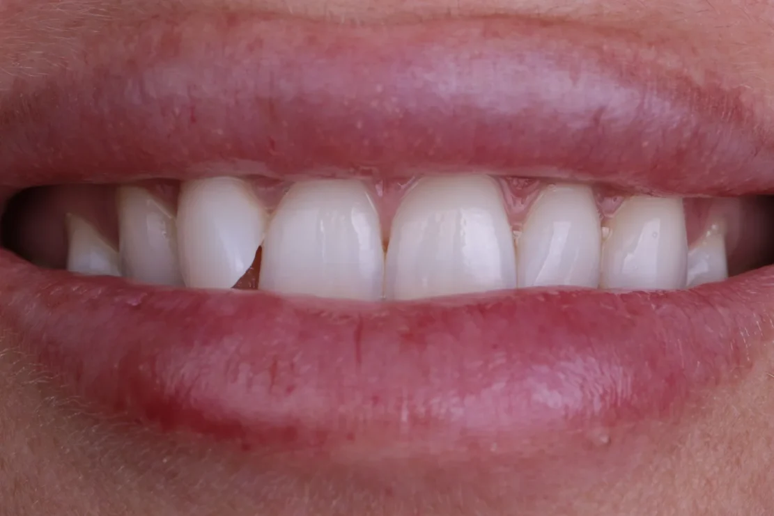 Before Image